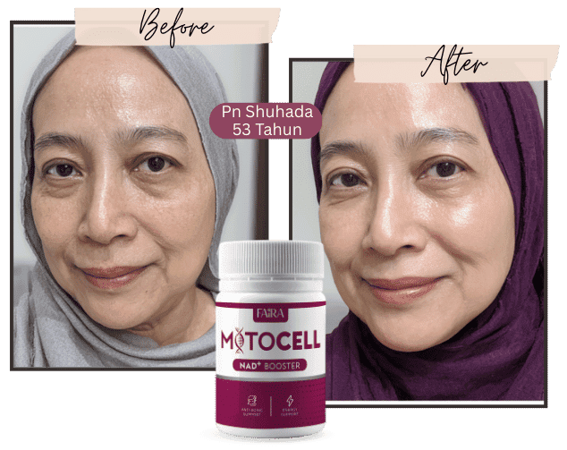 Mitocell_original_asli_testimoni_review_shopee_lazada_1